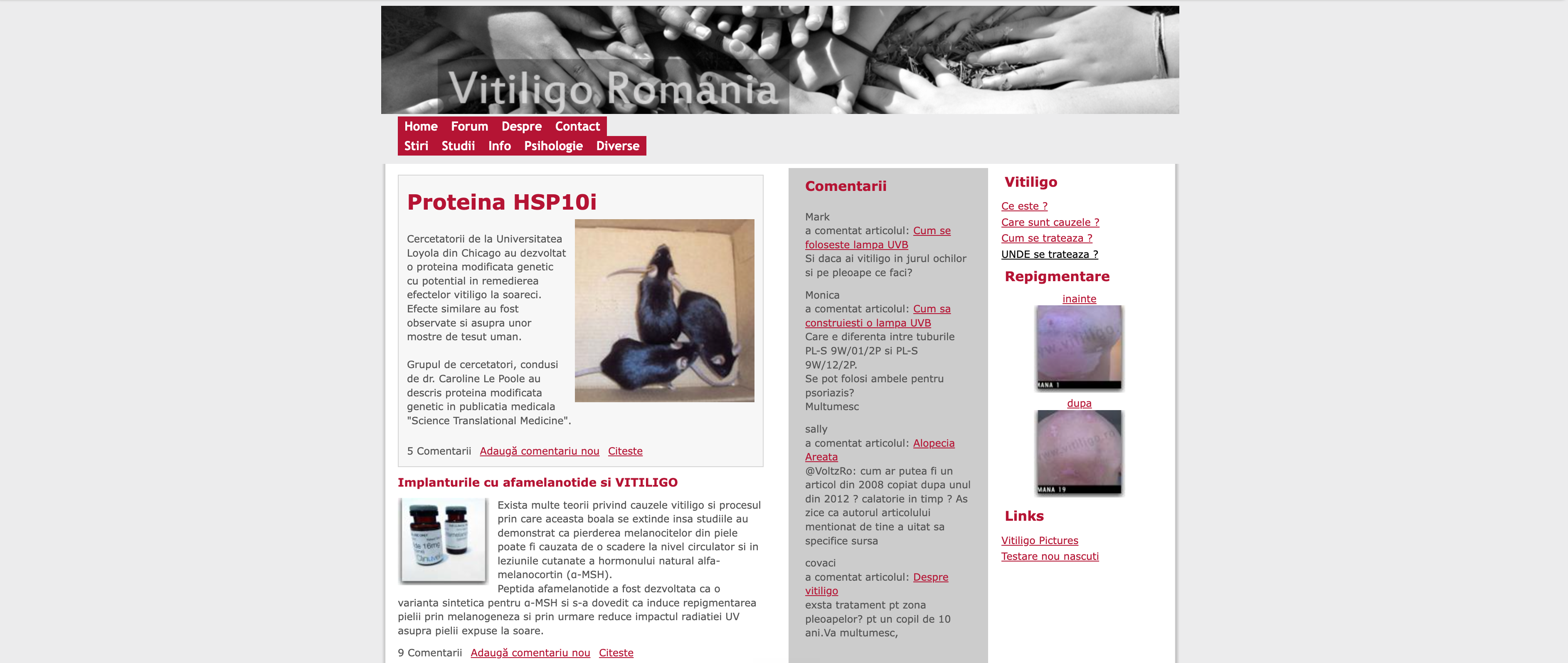 vitiligo.ro în 2016