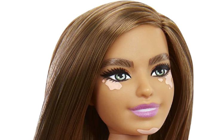 Păpușa Barbie cu vitiligo